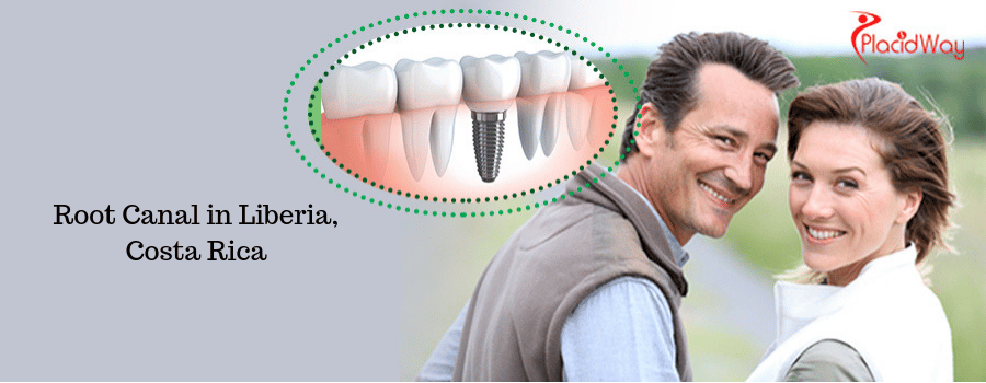 Effective Root Canal in Liberia, Costa Rica Effective Root Canal in Liberia, Costa Rica